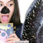 What is best for removing blackheads?