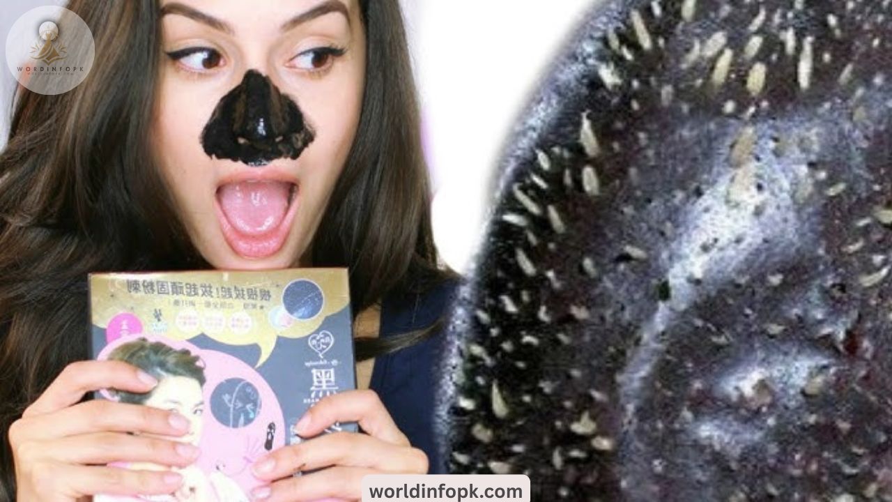 What is best for removing blackheads?